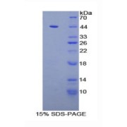 SDS-PAGE analysis of Complement C3 Protein.