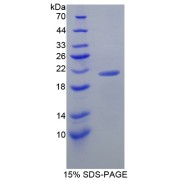 SDS-PAGE analysis of Lipocalin 8 Protein.