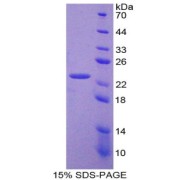 SDS-PAGE analysis of Frataxin Protein.