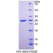 SDS-PAGE analysis of Talin Protein.