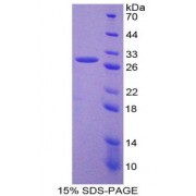 SDS-PAGE analysis of Glypican 3 Protein.