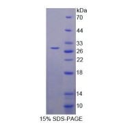 SDS-PAGE analysis of Glutaminase Protein.