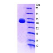 SDS-PAGE analysis of IL22RA2 Protein.