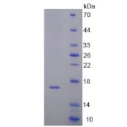 SDS-PAGE analysis of DTT Protein.