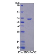 SDS-PAGE analysis of Dihydropyrimidine Dehydrogenase Protein.