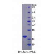 SDS-PAGE analysis of Sideroflexin 1 Protein.