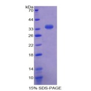 SDS-PAGE analysis of Phenol Sulfotransferase Protein.