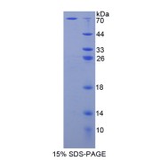 SDS-PAGE analysis of Adenosine Kinase Protein.