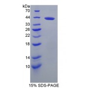 SDS-PAGE analysis of Brevican Protein.