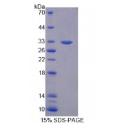 SDS-PAGE analysis of recombinant Mouse Tenascin X (TNX) Protein.