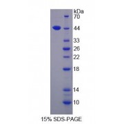 SDS-PAGE analysis of ACAT1 Protein.