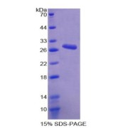 SDS-PAGE analysis of Anoctamin 1 Protein.