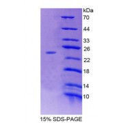 SDS-PAGE analysis of Adenylate Cyclase 7 Protein.