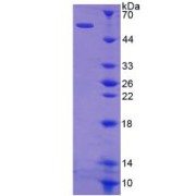 SDS-PAGE analysis of Kallikrein 1 Protein.