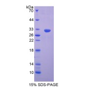 SDS-PAGE analysis of S Antigen Protein.