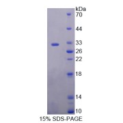 SDS-PAGE analysis of Glycine Dehydrogenase Protein.