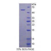SDS-PAGE analysis of recombinant Mouse CRAT Protein.