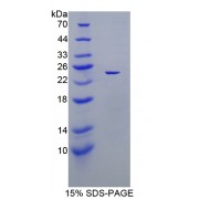 SDS-PAGE analysis of recombinant Mouse Xanthine Dehydrogenase Protein.