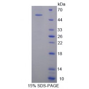 SDS-PAGE analysis of recombinant Mouse Oncostatin M Receptor Protein.