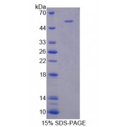 SDS-PAGE analysis of Selectin, Leukocyte Protein.