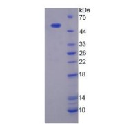 SDS-PAGE analysis of Mannose Associated Serine Protease 1 Protein.