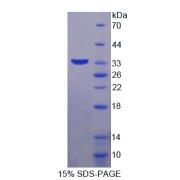 SDS-PAGE analysis of Aquaporin 9 Protein.