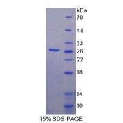 SDS-PAGE analysis of Cysteine Dioxygenase I Protein.