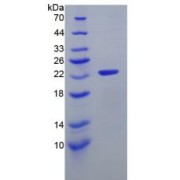 SDS-PAGE analysis of IL11 Protein.