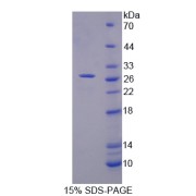 SDS-PAGE analysis of Midline 1 Protein.