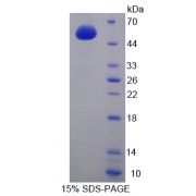 SDS-PAGE analysis of recombinant Mouse Adenylate Cyclase 9 Protein.