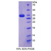 SDS-PAGE analysis of CYP27B1 Protein.