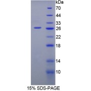 SDS-PAGE analysis of IL12A Protein.