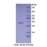 SDS-PAGE analysis of recombinant Mouse Fibrillin 1 FBN1 Protein.