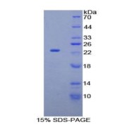 SDS-PAGE analysis of Fibrillin 1 Protein.