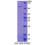 SDS-PAGE analysis of Myosin Light Chain 3, Alkali, Ventricular, Slow Skeletal Protein.