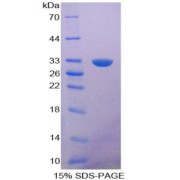 SDS-PAGE analysis of Nitric Oxide Synthase Trafficker Protein.