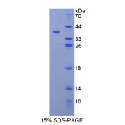 SDS-PAGE analysis of MMP10 Protein.