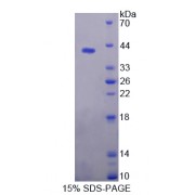 SDS-PAGE analysis of recombinant Mouse Phospholipase A2 Receptor 1 Protein.