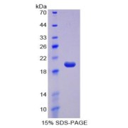 SDS-PAGE analysis of Cluster Of Differentiation 160 Protein.