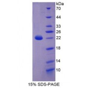 SDS-PAGE analysis of Keratin 18 Protein.