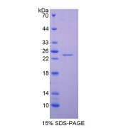 SDS-PAGE analysis of NGAL Protein.