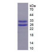 SDS-PAGE analysis of recombinant Pig Cardiac Troponin T2 (TNNT2) Protein.