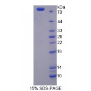SDS-PAGE analysis of Plasminogen Activator, Tissue Protein.