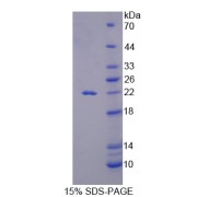 SDS-PAGE analysis of IL18 Protein.