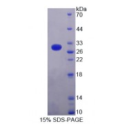 SDS-PAGE analysis of Cardiac Troponin I (TNNI3) Protein.