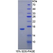 SDS-PAGE analysis of Selectin, Endothelium Protein.