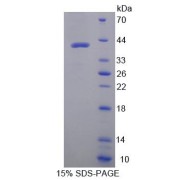 SDS-PAGE analysis of Osteocalcin Protein.