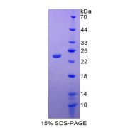 SDS-PAGE analysis of IL18 Protein.