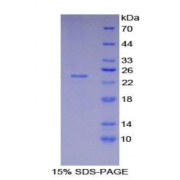 SDS-PAGE analysis of Major Histocompatibility Complex Class II DR alpha Protein.