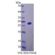 SDS-PAGE analysis of SHBG Protein.